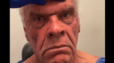 Hombre se hizo rejuvenecimiento facial y quedo hasta de buen humor